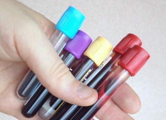 Blood Tests for Depression