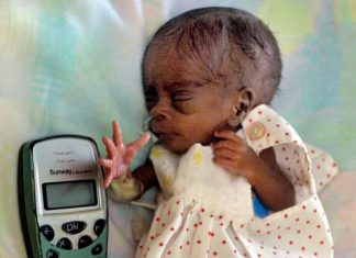 Britain’s Smallest Baby Now A Teenager
