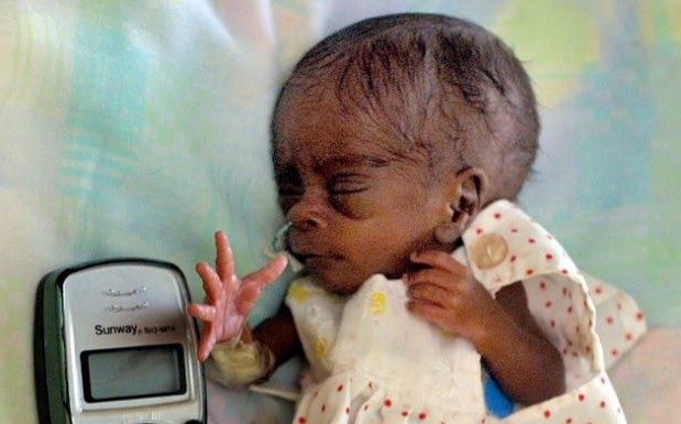 Britain’s Smallest Baby Now A Teenager