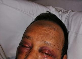 Brutal Attack on Taxi Driver